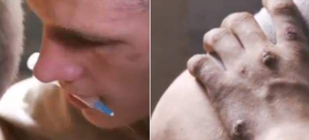 Adictos al krokodil Adictos al krokodil
